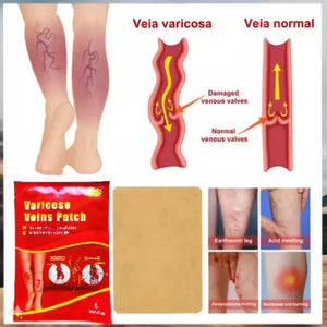 PARCHES PARA VARICES