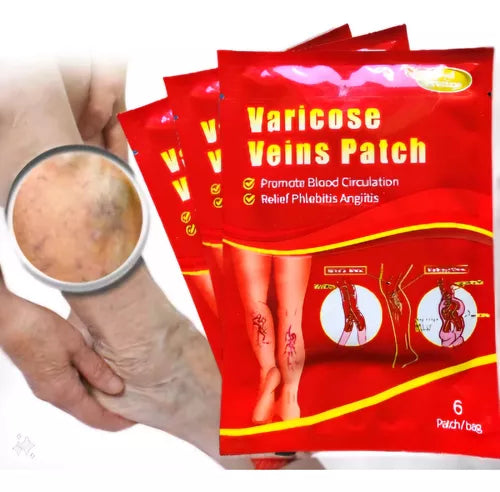 PARCHES PARA VARICES